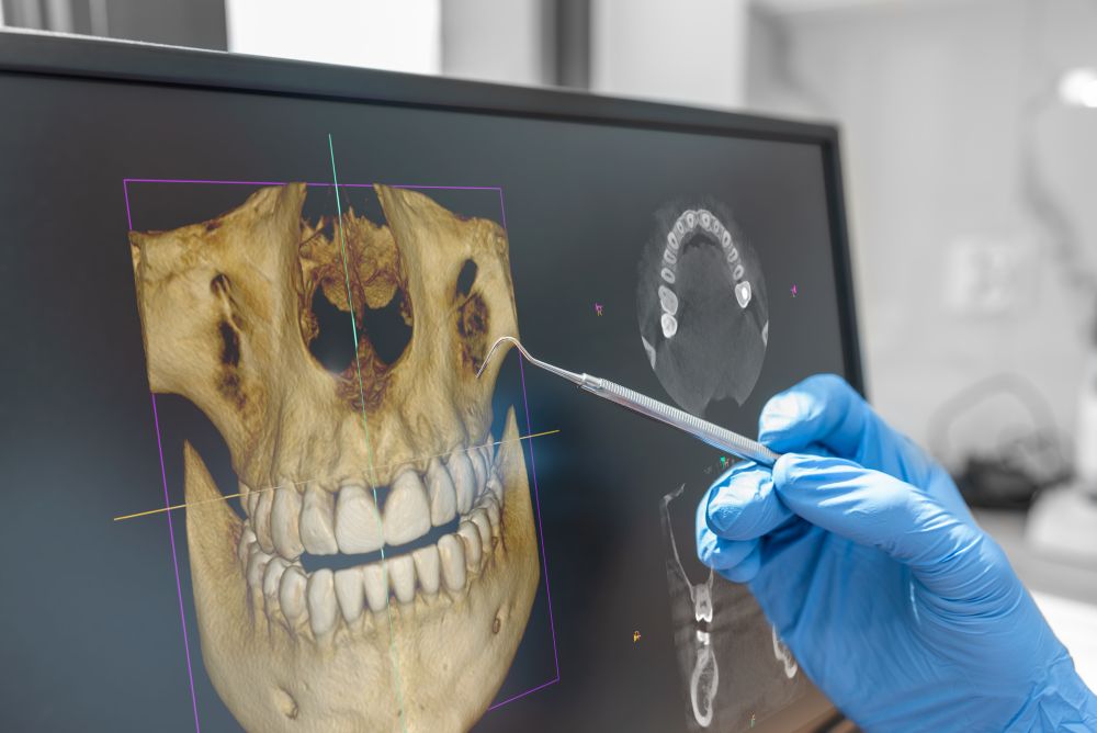 Reviewing a 3D dental x ray