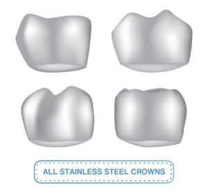 Diagram of Stainless Steel Crowns for Children - The Super Dentists