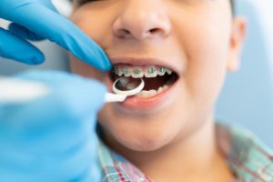 Boy with braces