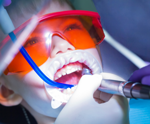Child having Fluoride Treatment at The Super Dentists