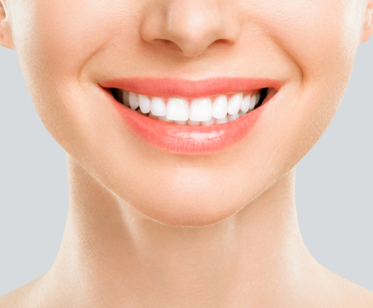 Before & After Teeth Whitening at The Super Dentists