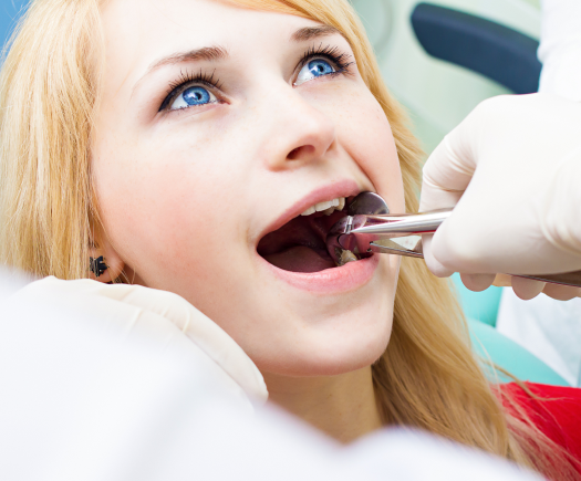 Girl in the process of Wisdom teeth treatment at The Super Dentists