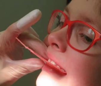 San Diego Moms: What I Learned About My Kid’s Teeth