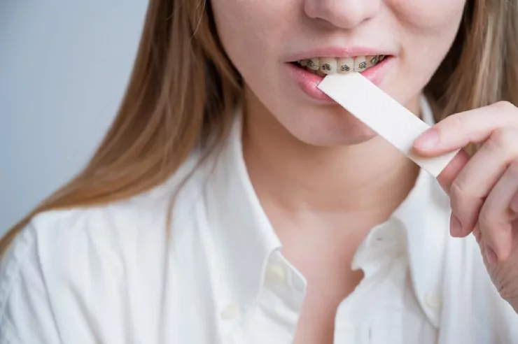 Girl with braces biting a piece of gum