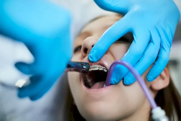 Orthodontist removes a teenage girl’s teeth braces