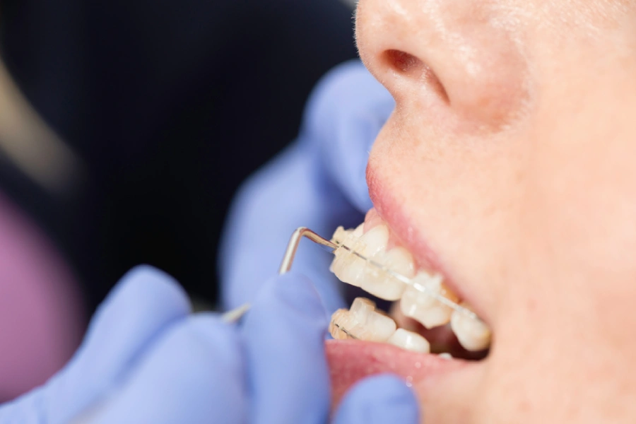 Teenage redheaded caucasian boy gets braces tightened for the first time