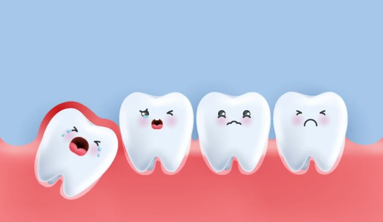 A cute representation of molars, with the first signs of wisdom teeth coming in being depicted by a crying sideways wisdom tooth pushing against a red and swollen gum.
