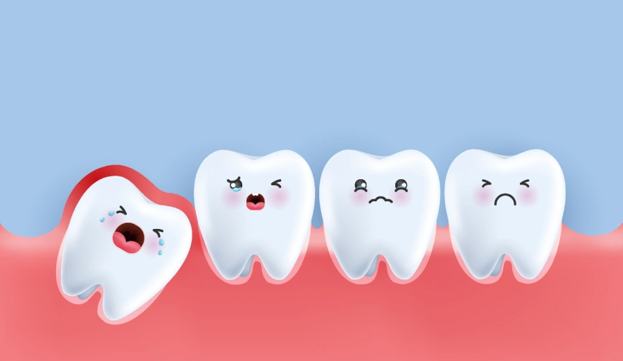 A cute representation of molars, with the first signs of wisdom teeth coming in being depicted by a crying sideways wisdom tooth pushing against a red and swollen gum.