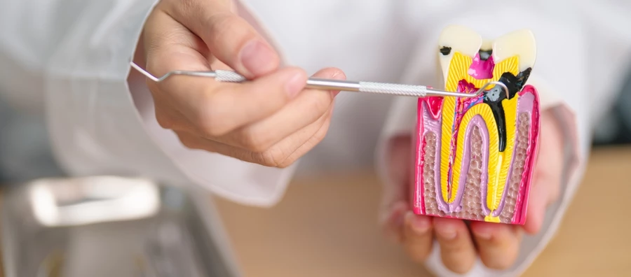 Dentist holds an instrument against a cross section of a tooth to demonstrate its interior makeup