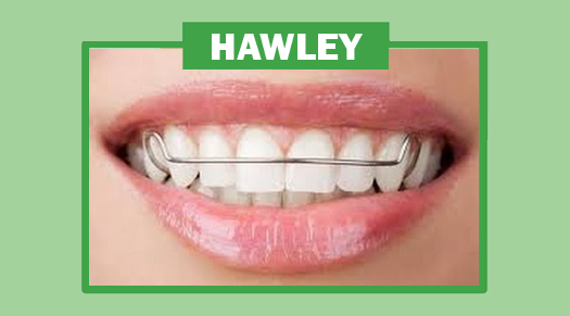 Hawley Retainers - The Super Dentists