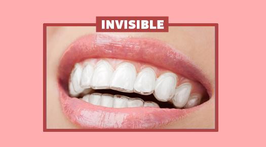 Invisible Retainers - The Super Dentists