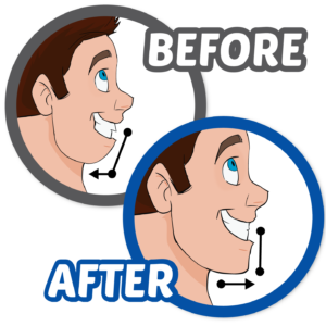 Animated Person showing Before & After Orthodontic Results at The Super Dentists