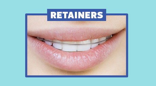 Traditional Retainers - The Super Dentists