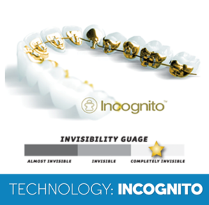 image of incognito braces for adults